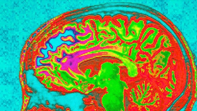 Colourful brain image