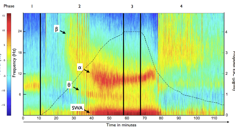 Spectrogram of an ultraslow induction and recovery from propofol anaesthesia