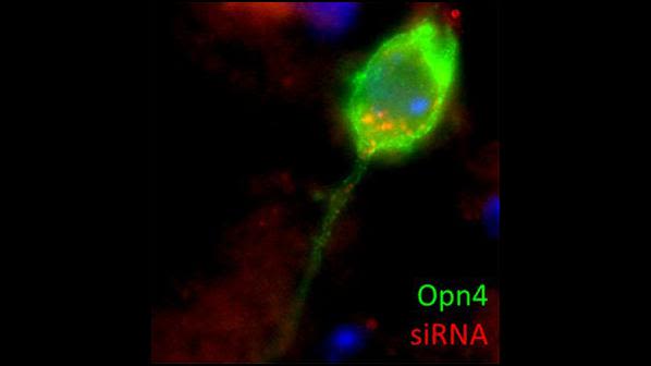 Melanopsin-expressing retinal ganglion cell (green) transfected with siRNA (red).