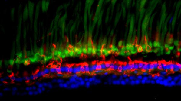 Melanopsin-expressing neurones in sections of the zebrafish retina